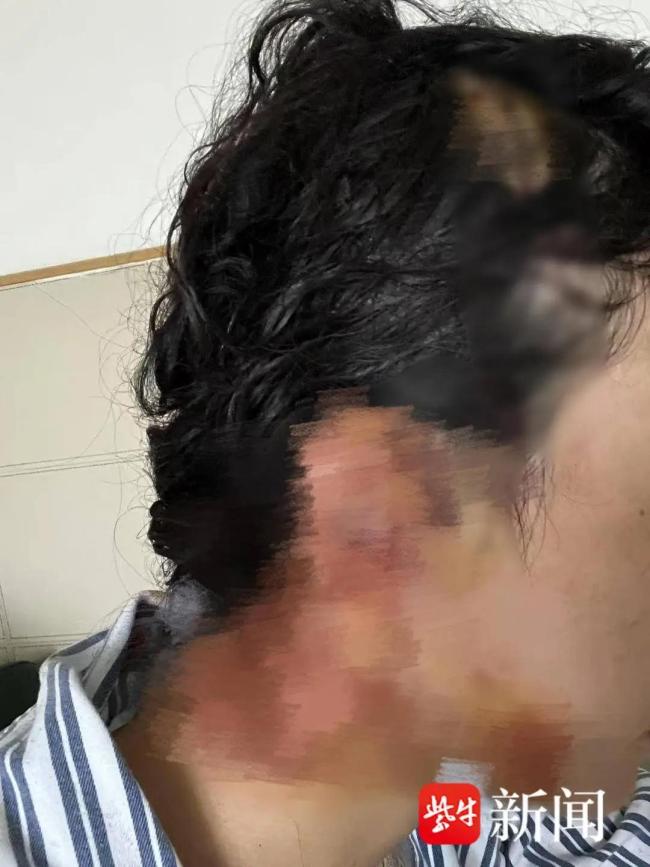凯发k8官网登录vip入口员工忘系安全带致游客受伤 景区回应与赔偿争议(图2)