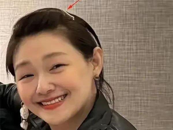 凯发k8·(国际)官方网站大S生前未P图几张照片流出面颊浮肿眼睁不开腰腹部隆起身(图2)