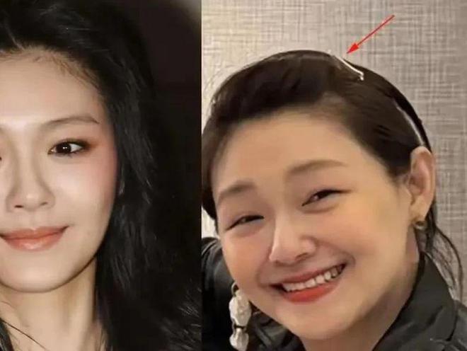 凯发k8·(国际)官方网站大S生前未P图几张照片流出面颊浮肿眼睁不开腰腹部隆起身(图3)